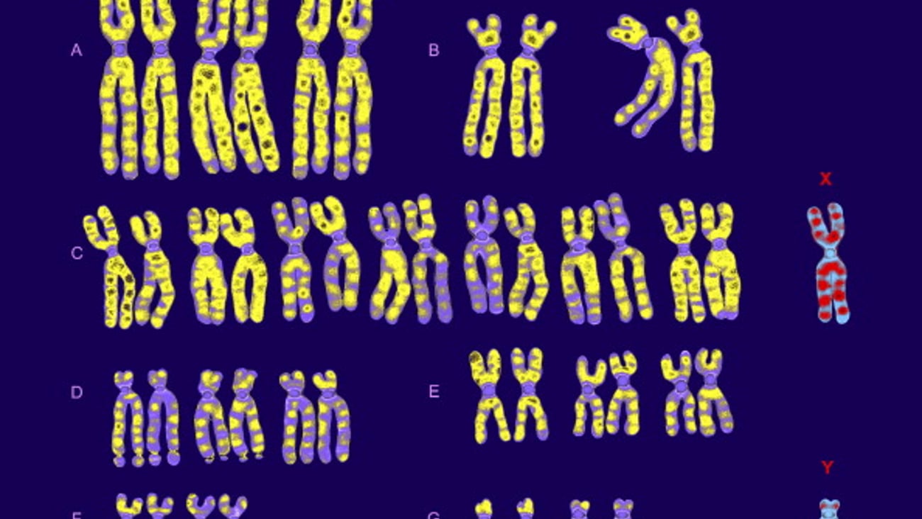 Chromosomes X et Y disposés selon la classification de Denver.