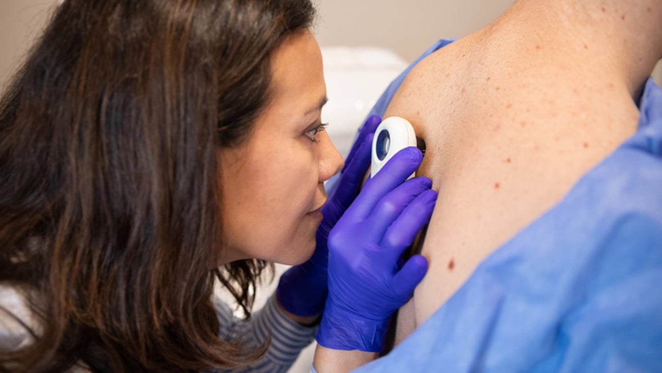 Une dermatologue inspecte la peau du dos d'un patient à l'aide d'une loupe.