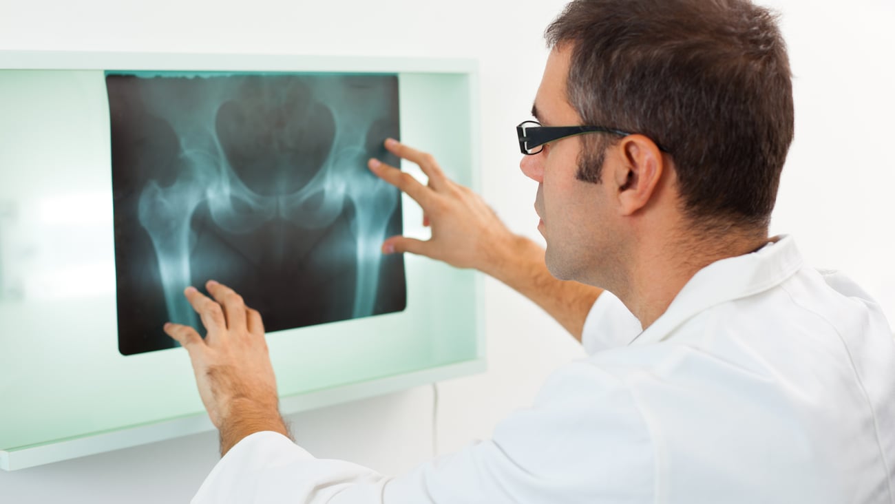 Médecin qui analyse une radio