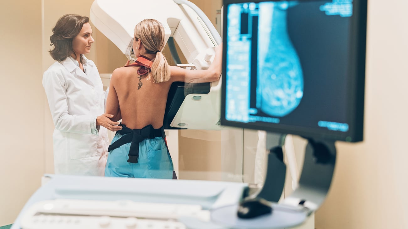 Dépistage du cancer du sein par mammographie