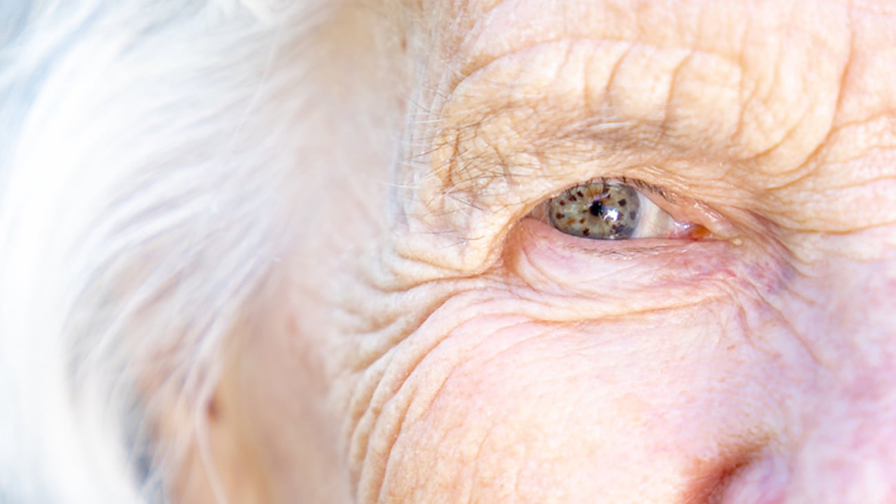 Gros plan sur l'oeil d'une personne âgée, représentant la vue et la vision.