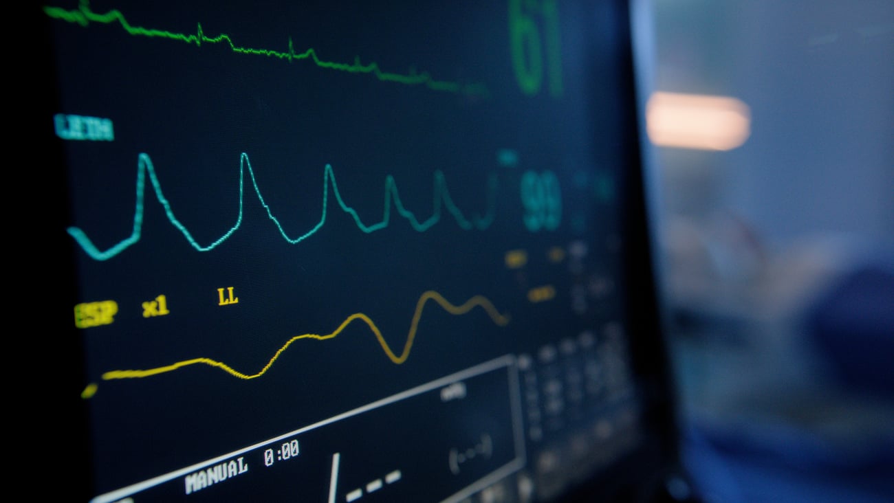 Cardiogramme. Crédit photo: Bevan Goldswain/Getty Images