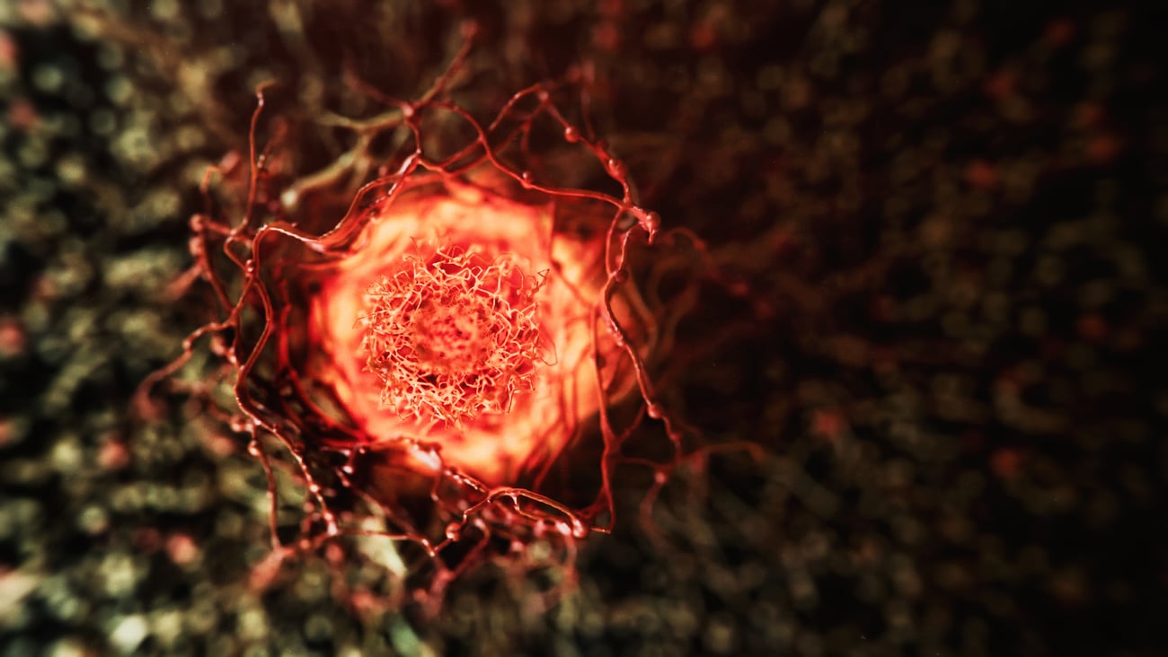 Vue d'une cellule cancéreuse. Crédit photo: koto_feja/ Getty Images
