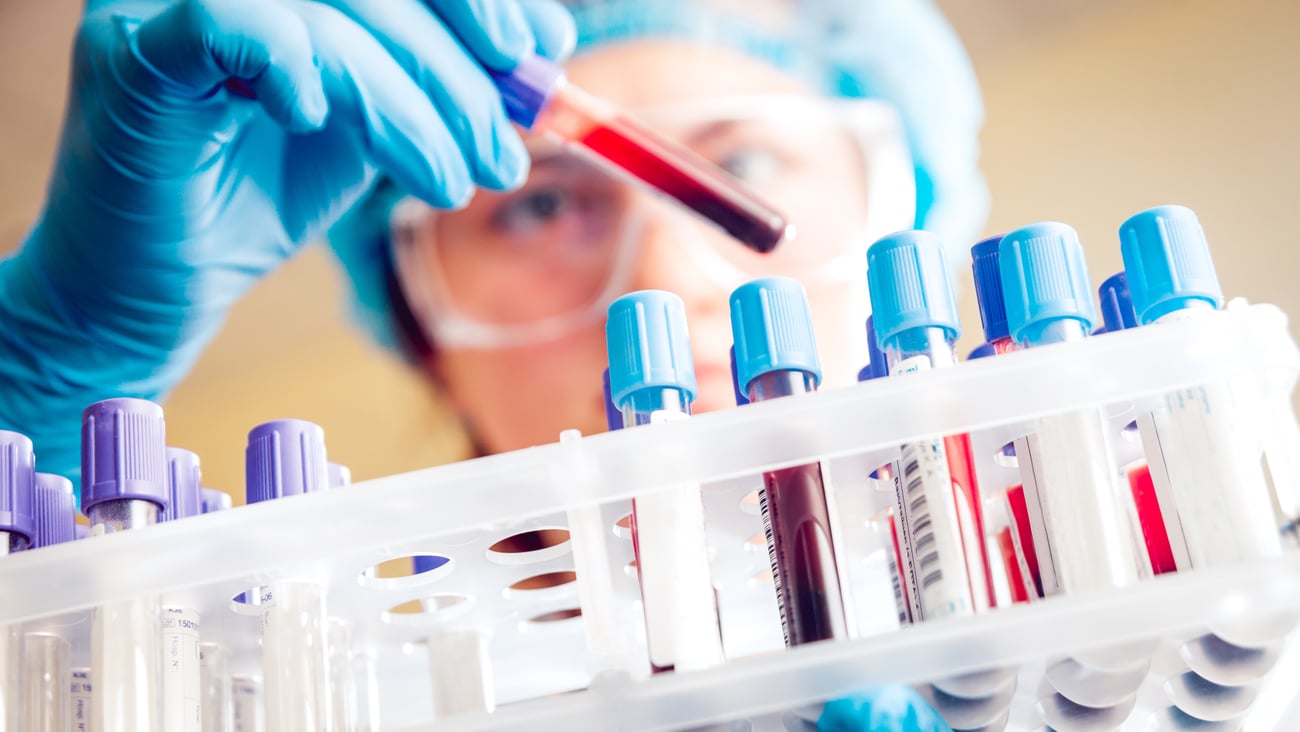 blood-lab_326298698.