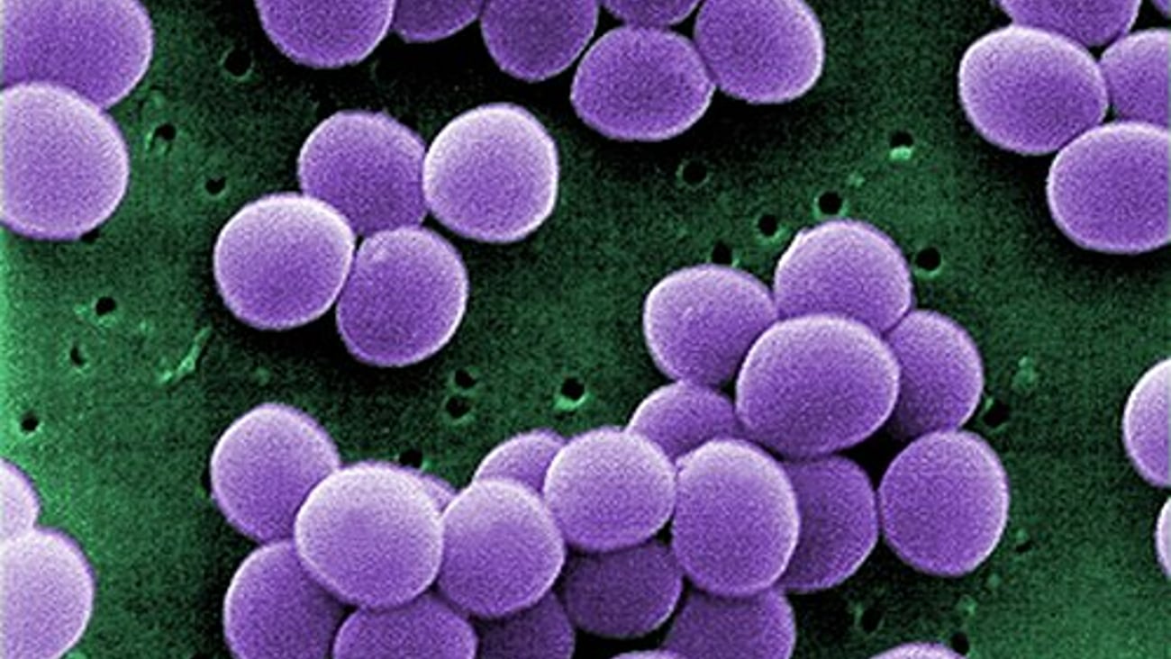 Staphylococcus aureus (Photo: CDC/ Matthew J. Arduino, DRPH / Janice Haney Carr - CDC (PHIL))
