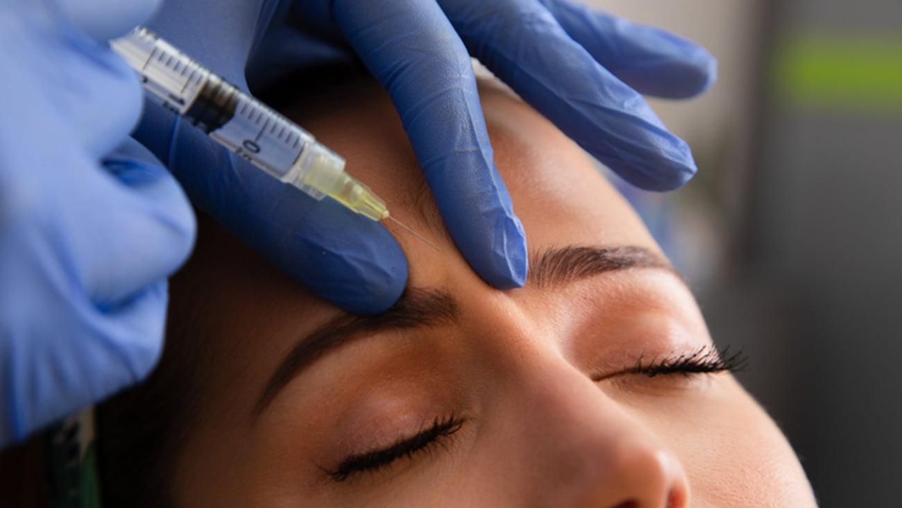 Un médecin injecte du botox dans la ride du lion de sa patiente