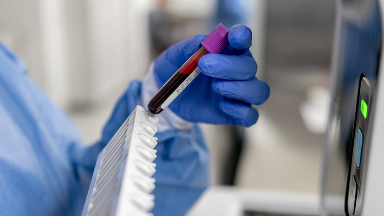 Une médecin tient une fiole remplie de sang pour réaliser un test sanguin