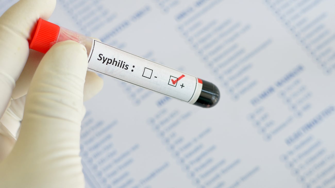 Test positif à la syphilis