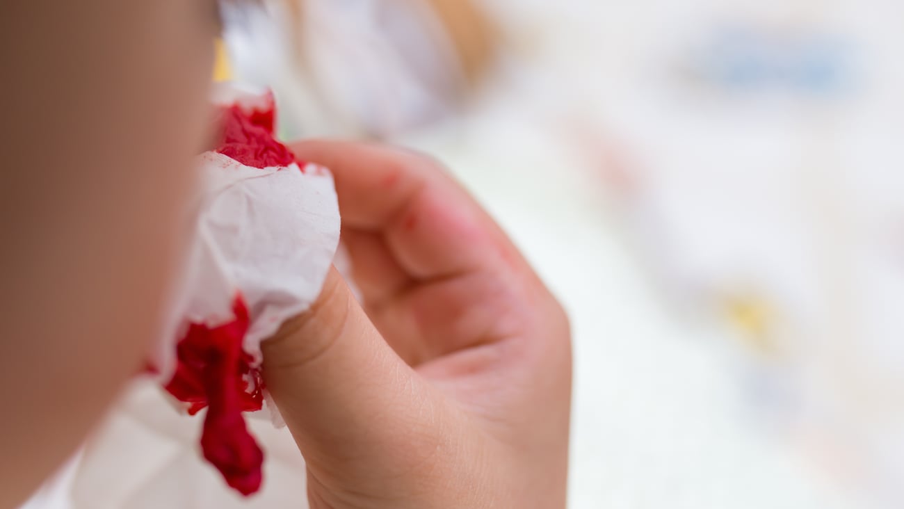 Saignement du nez