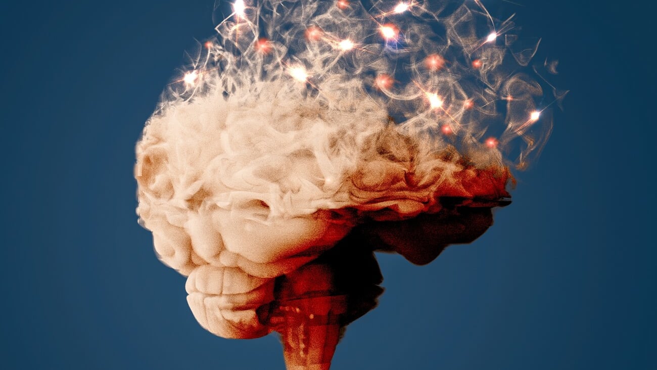 Brain seen from the side. Degenerative disease. Brain degenerative diseases, Parkinson, synapses, neurons, Alzheimer's, illness, concept. 3d rendering