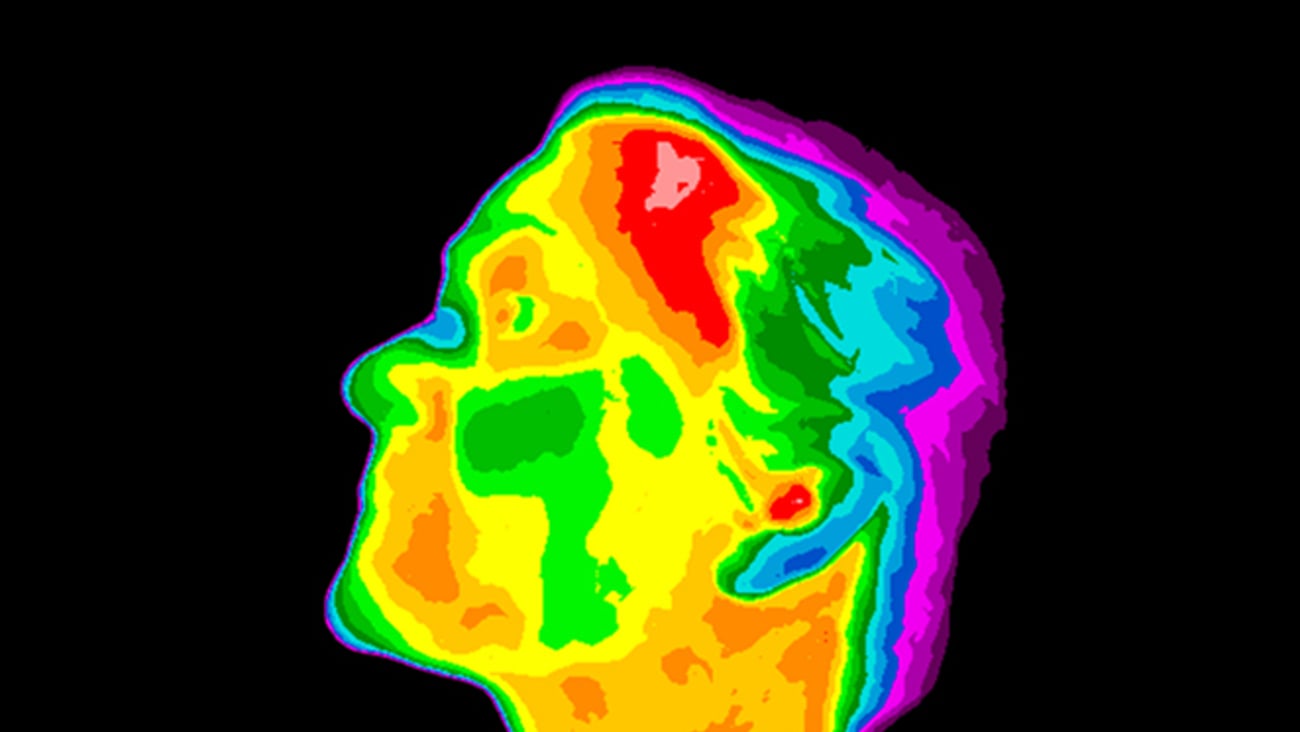 Image thermique d'un visage.