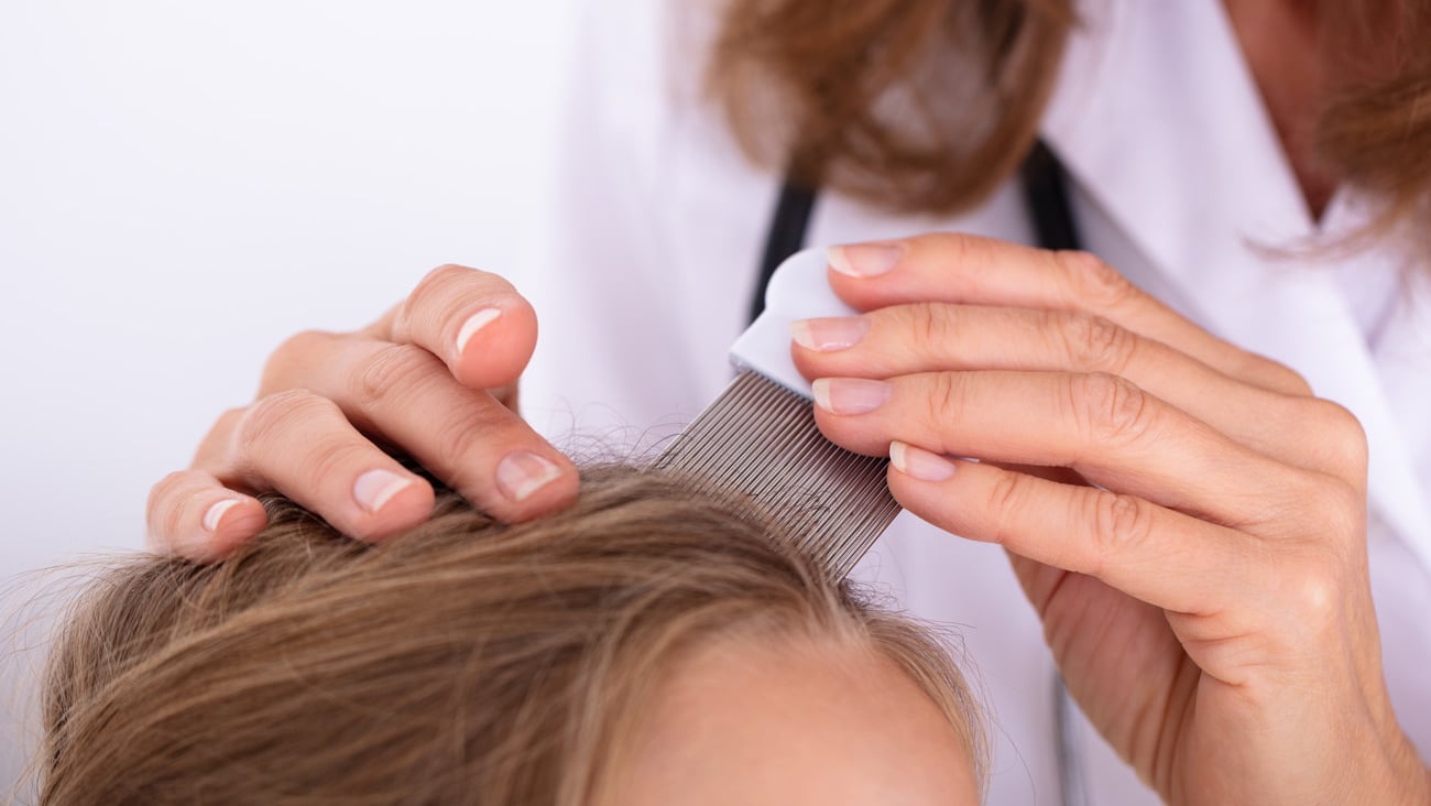 Close-up Of A Doctor Examining Girl's Hair With Comb; Shutterstock ID 1252772110