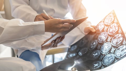 ces médecins discutent devant des images de cerveau