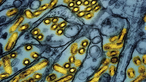 Cette image de microscope électronique colorisée publiée par le National Institute of Allergy and Infectious Diseases, le 26 mars 2024, montre des particules du virus de la grippe aviaire A H5N1, en jaune. (CDC/NIAID via AP, Archive) Uncredited