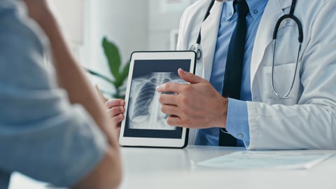 Un médecin montre une radiographie des poumons à un patient.