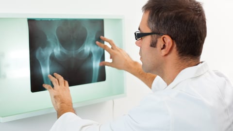 Médecin qui analyse une radio