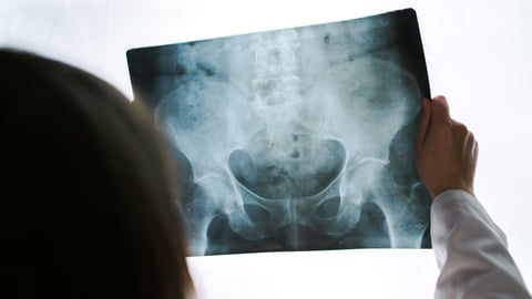 Un médecin examine une radio de la hanche