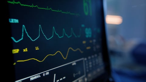 Cardiogramme. Crédit photo: Bevan Goldswain/Getty Images