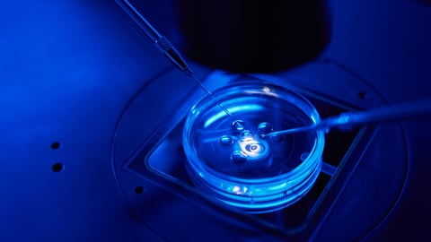 Le spermatozoïde est injecté dans l'ovule à l'aide d'une micro-aiguille et d'une pipette de maintien sous microscope. Crédit photo: Svitlana Hulko/ Getty Images