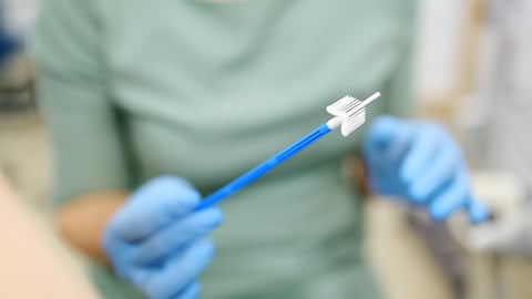 Un gynécologue examine une patiente et prélève un frottis sur le col de l’utérus d’une femme pour dépister le VPH.