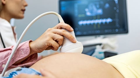 Une femme en train d'avoir une échographie en clinique.