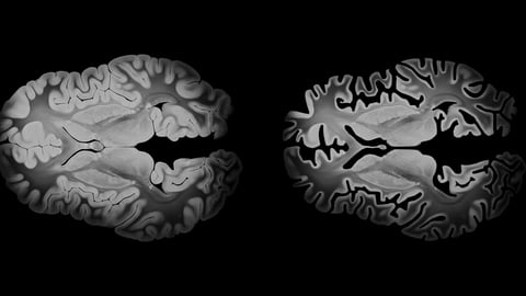 Scan d'un cerveau