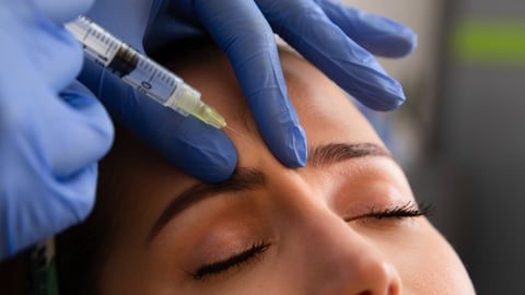 Un médecin injecte du botox dans la ride du lion de sa patiente