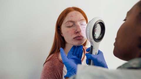 Une pharmacienne réalise le diagnostic de peau d'une jeune femme avec des tâches de rousseur et des boutons