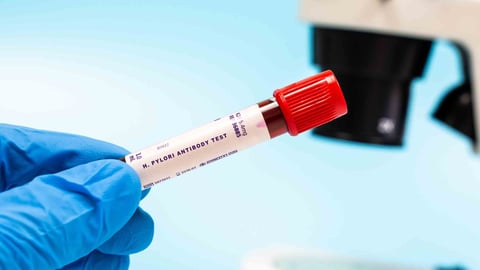 h_pylori_test