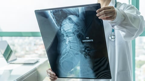 Un médecin examine une radio du dos